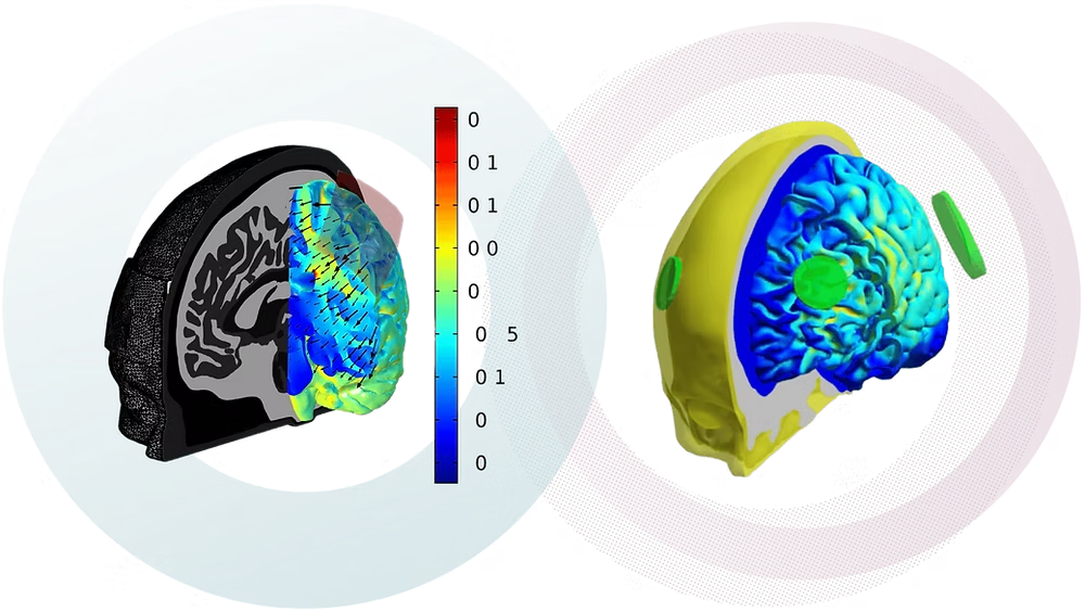 3D Brain Mapping Visualization
